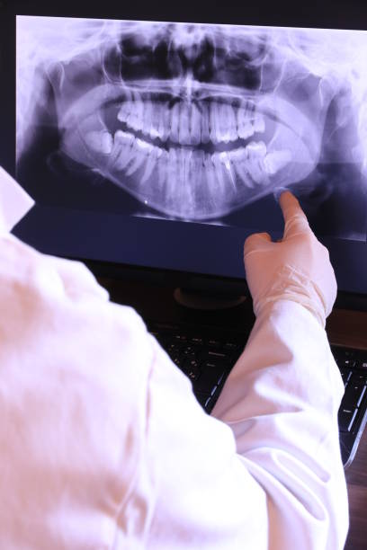 Best Emergency Tooth Extraction in Ramsey, MN