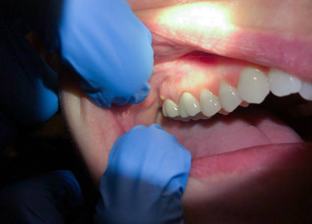 Best Emergency Dental Surgery in Ramsey, MN